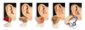 audiologia audifonos para sordos